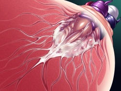 x-Ray_02